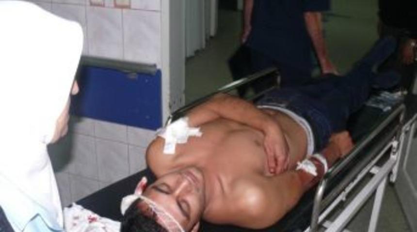 Amca İle Yeğenini Meyve Bah&ccedil;esinde Vurdu