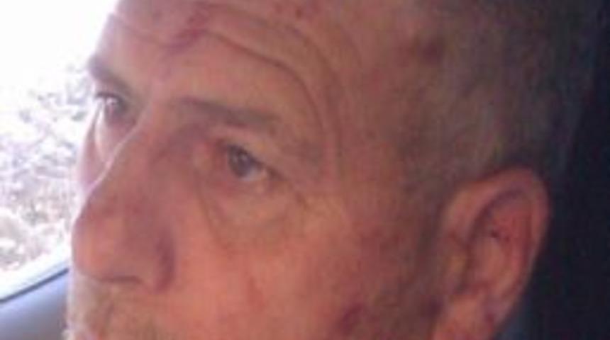 Oğlunu Bı&ccedil;akladı