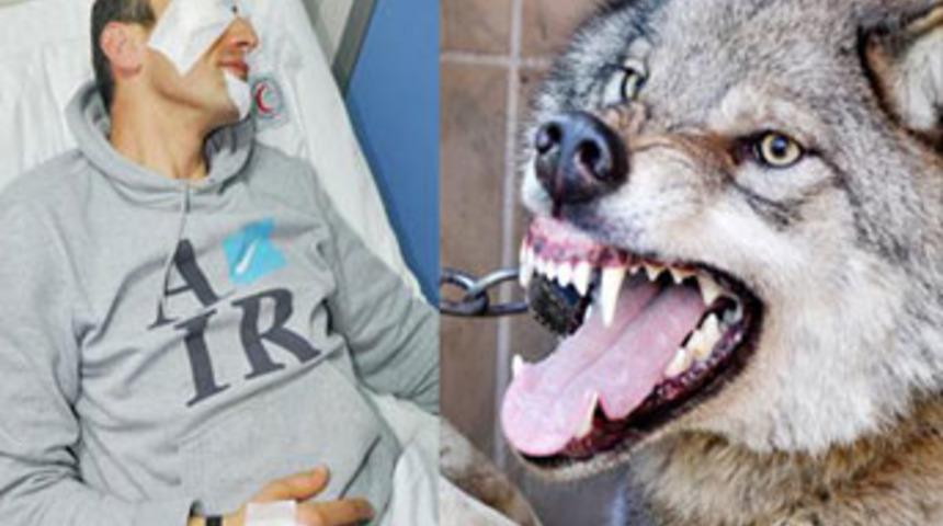 Evde beslediği kurdun saldırısına uğradı