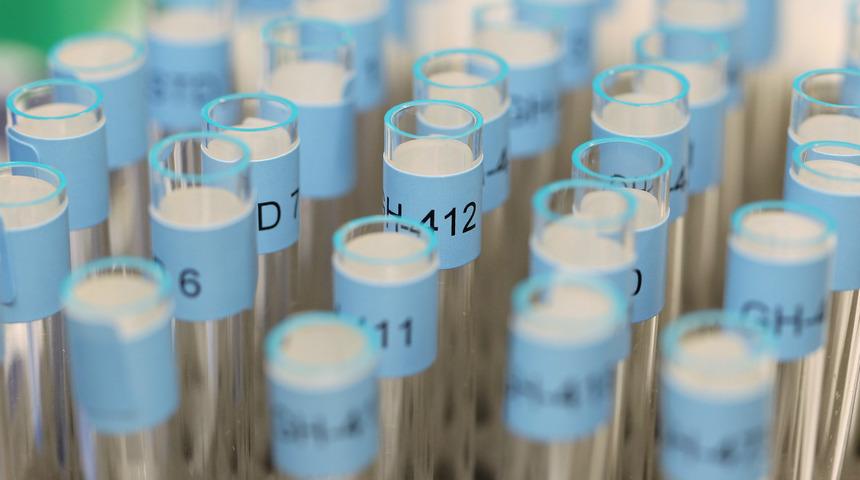 FIFA açıkladı: Dünya Kupası'nda doping yok