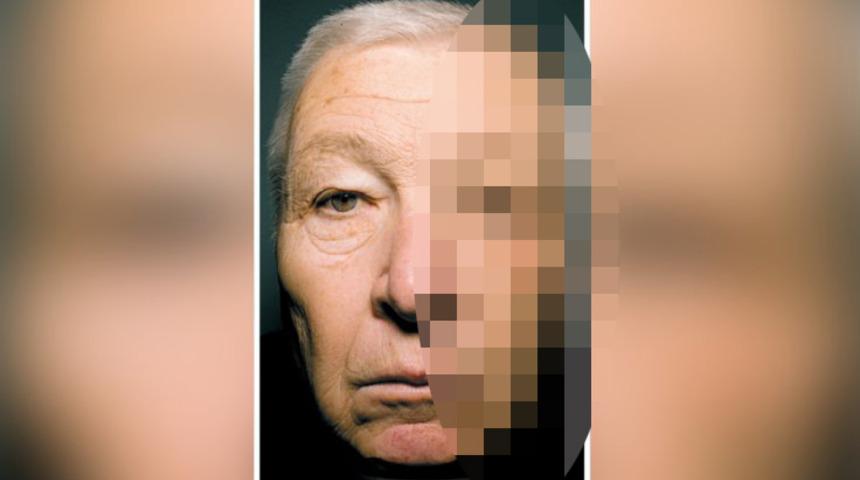 Yüzünün yarısı 20 yıl daha hızlı yaşlandı!