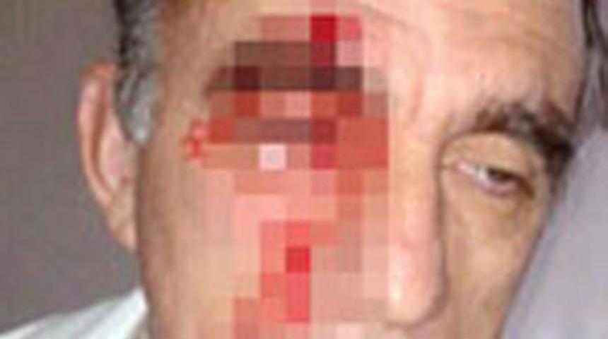 Hasta yakınları doktoru d&ouml;vd&uuml;