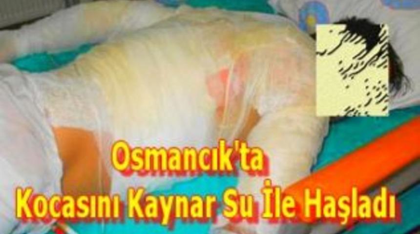 Osmancık'ta kocasını kaynar su ile haşladı