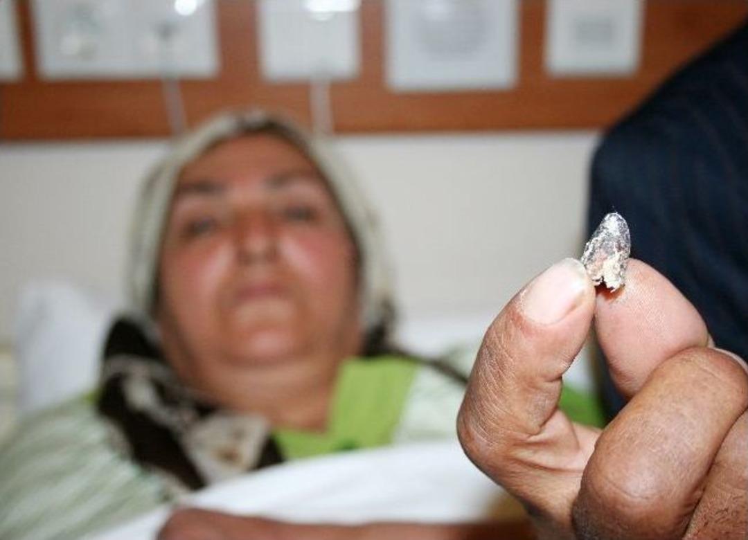 10 yıl kurşunla yaşadı