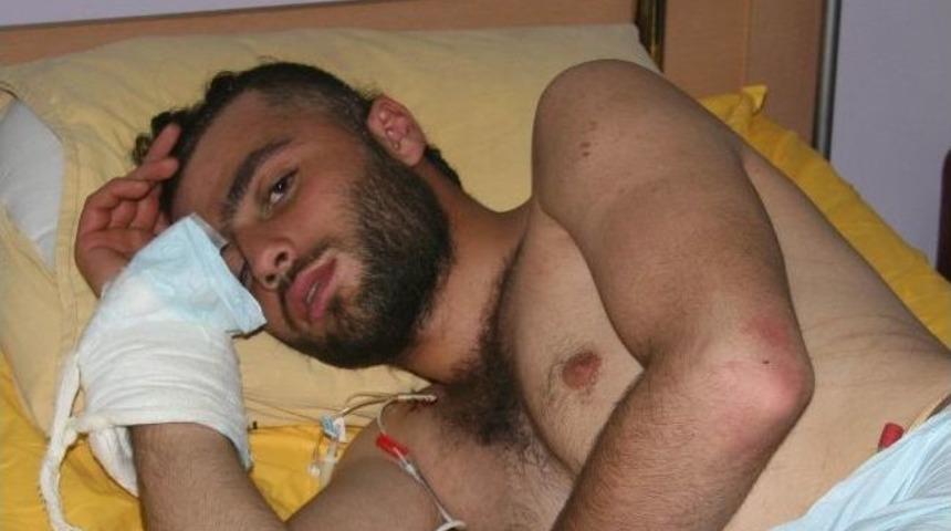 Suriye'den Getirilen 10 Yaralıdan Biri &Ouml;ld&uuml;