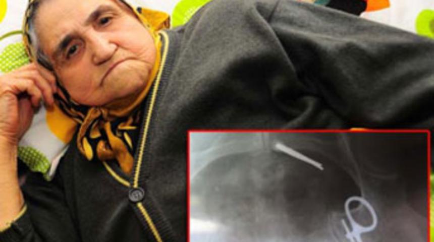 11 yıl v&uuml;cudunda makasla yaşadı