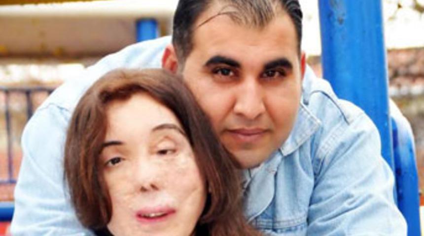 Y&uuml;z nakli bekleyen Dilek evleniyor