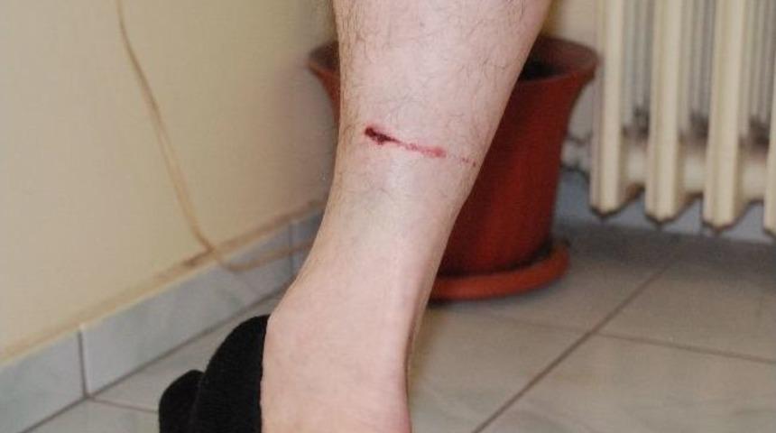 &Ccedil;anakkale'de 3 Kişiyi Isıran &Ccedil;akal Kuduz &Ccedil;ıktı