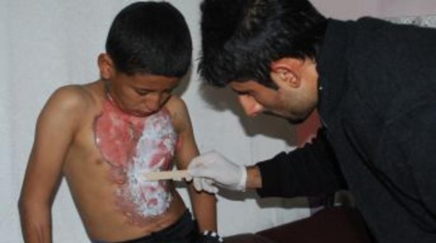 Arkadaşını Benzinle Yaktı