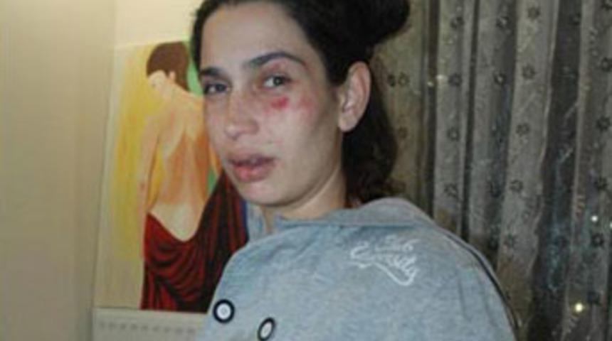 8 aylık hamile karısını hastanelik etti