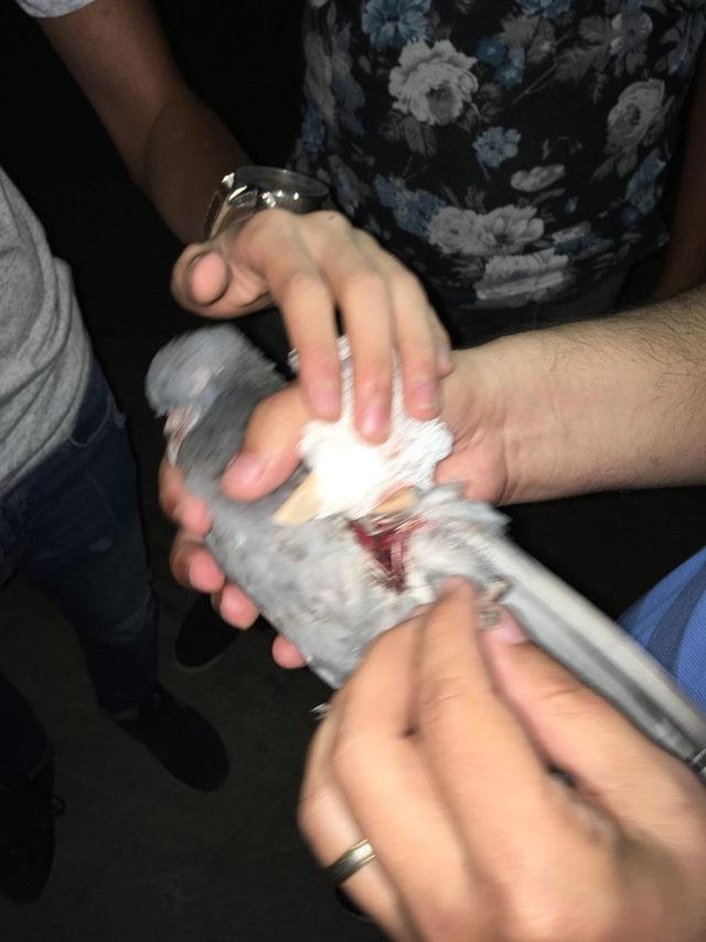 Yaralı güvercin tedaviye alındı
