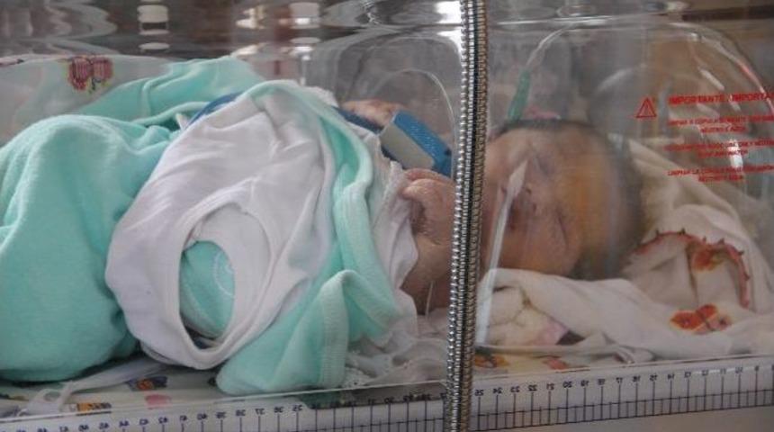 Kalp Hastalığı Bulunan Bebek Hayata Tutunmaya &Ccedil;alışıyor