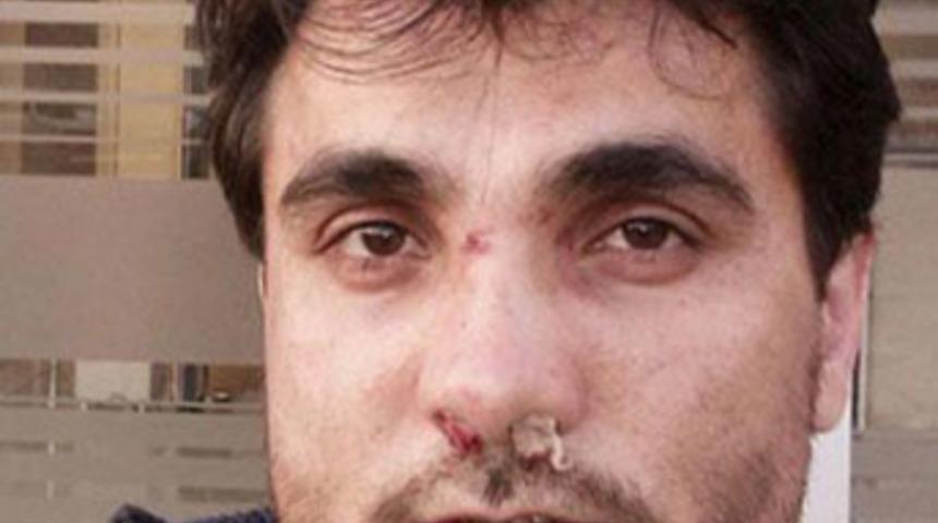 Albay eşcinsel oğlunu ka&ccedil;ırdı