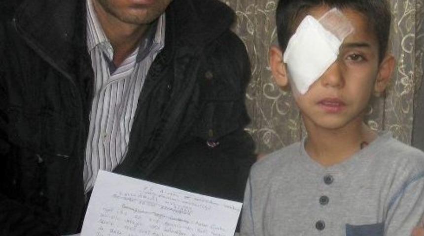 Sağ G&ouml;z&uuml;n&uuml; Kapı Kolu K&ouml;r Etti İddiası