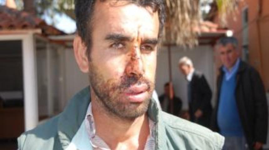 Kuzeninin Y&uuml;z&uuml;ne Testereyle Vurdu