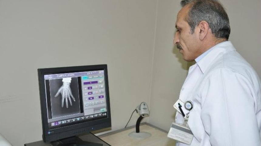 Yerk&ouml;y Devlet Hastanesi R&ouml;ntgenler Hastaya Cd Ortamında Verilmeye Başladı