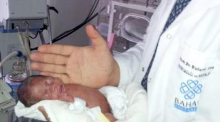 630 Gramlık Ikiz Parmak Bebekler, Hayata Tutundu