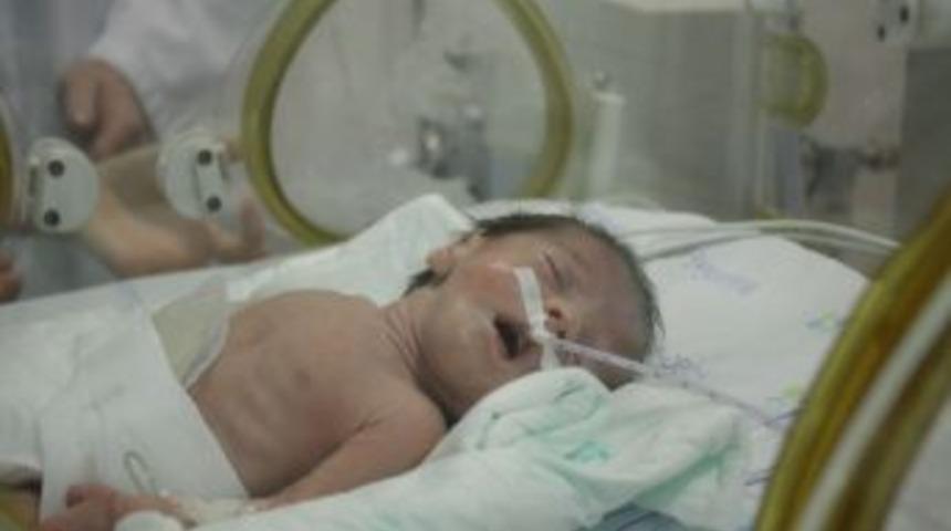 Ameliyat Edilen 800 Gramlık Bebek Hayata Tutundu