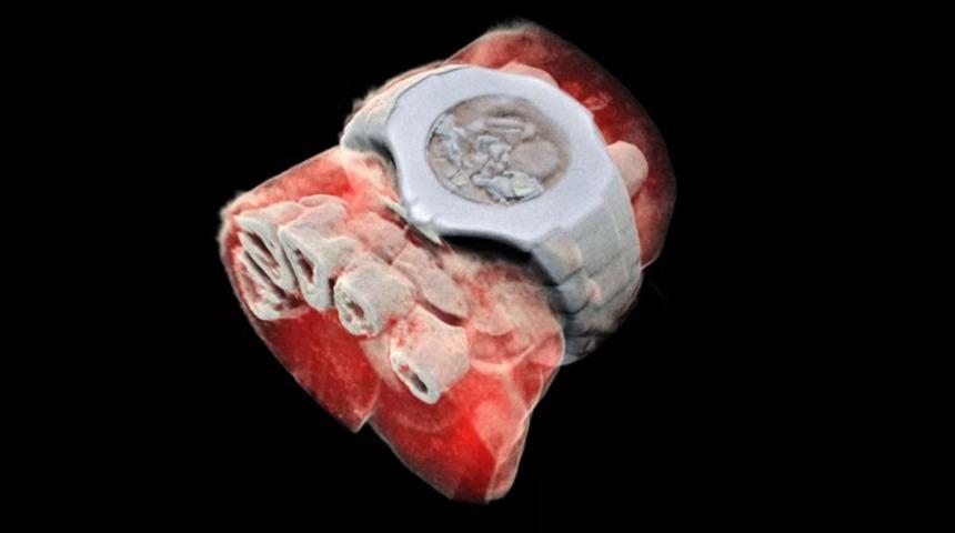 Renkli ve 3 boyutlu röntgen dönemi başlıyor