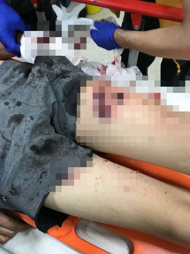 Kutlamalarda kullanılan top mermisi patladı: 4 çocuk yaralı