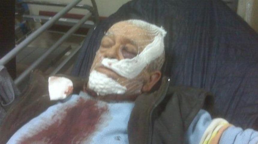 Baba Ve Oğula Bı&ccedil;aklı Saldırı