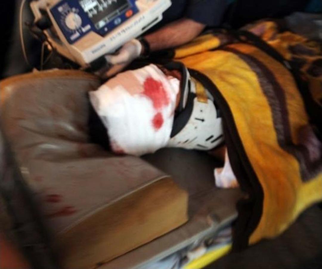 Arazide Bulduğu Cisim Elinde Patlayan &Ccedil;ocuk Yaralandı