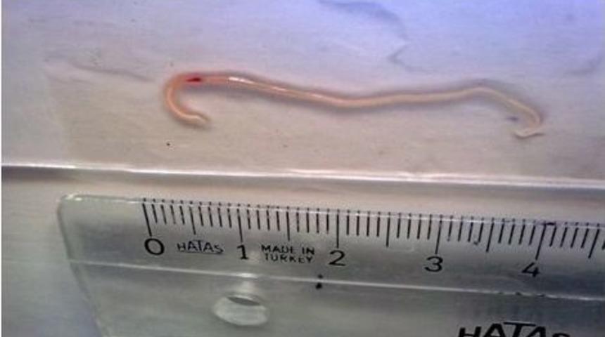 Eğirdir G&ouml;l&uuml;&rsquo;ndeki Sudak Balığında Parazit Tespit Edildi