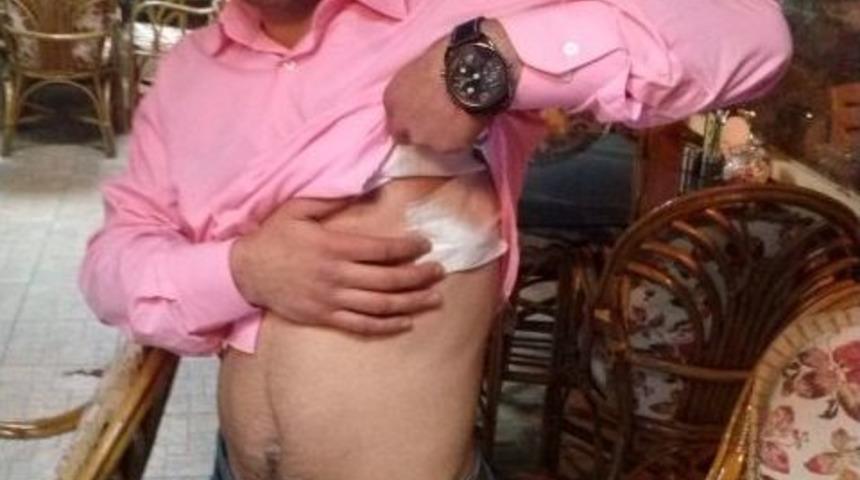 &Uuml;st Devre Dayağı Hastanelik Etti