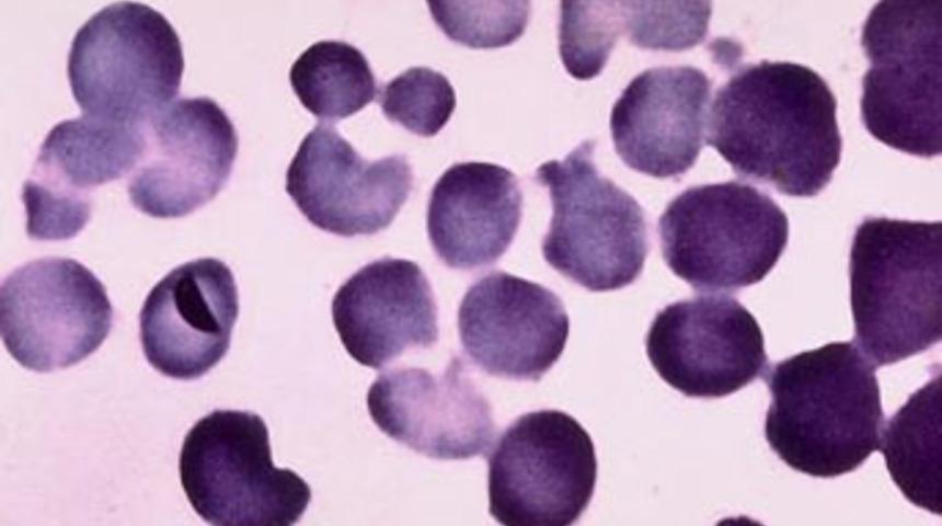 Tarihin en b&uuml;y&uuml;k 10 hatalı &uuml;r&uuml;n vakası