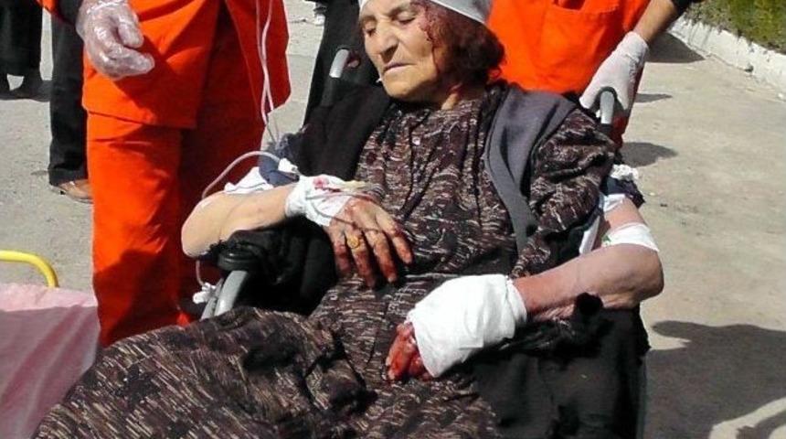 &Ccedil;oban k&ouml;pekleri yaşlı kadının kulağını kopardı