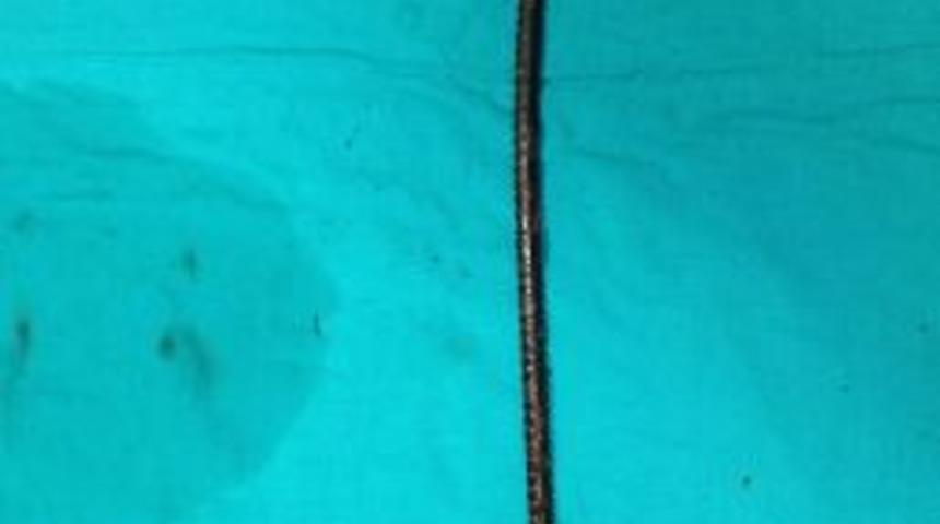 G&ouml;ğs&uuml;n&uuml; Delip Ge&ccedil;en Demirle Hastaneye Kaldırıldı