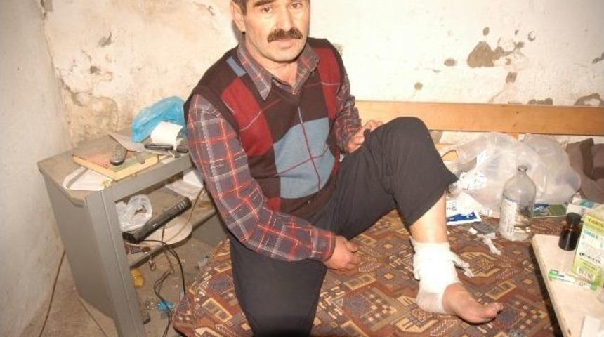 5 Bin Lira Bulamazsa Bacağı Kesilecek