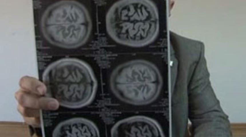 Beyninde 'Allah' yazısı &ccedil;ıktı!