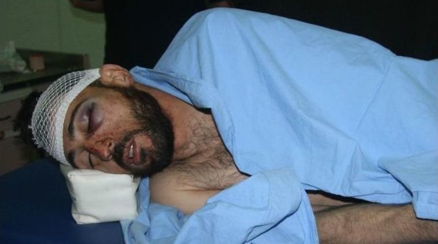 Kilis'e Getirilen 34 Suriyeli Yaralıdan 4&rsquo;&uuml; Hayatını Kaybetti