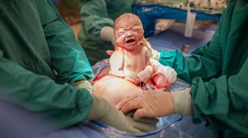 En g&uuml;zel doğum fotoğrafları