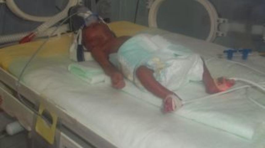 12 G&uuml;n &Ouml;nce D&uuml;nyaya Gelen 560 Gramlık Parmak Bebek Hayata Tutundu