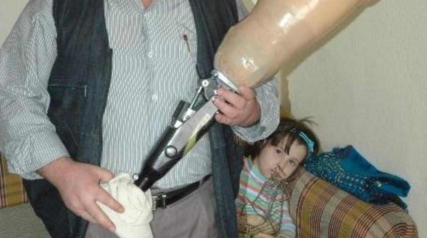 Gaziye Protez Bacağı İ&ccedil;in İcra Takibi