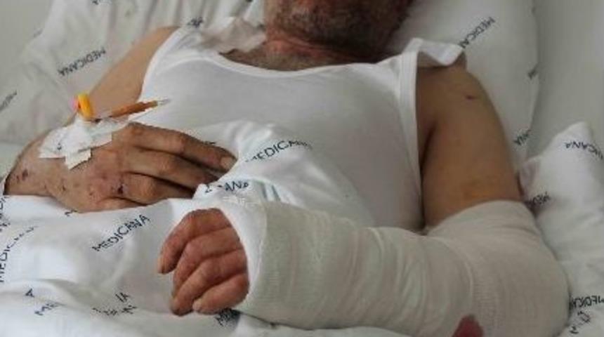 (özel Haber) Kopan Kolu Yerine Dikildi