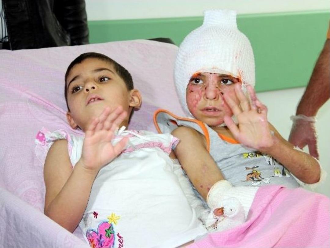 (&ouml;zel Haber) Esad&rsquo;ın Bombalarının Yaktığı Suriyeli &Ccedil;ocuklar Samsun&rsquo;da Tedavi Edildi