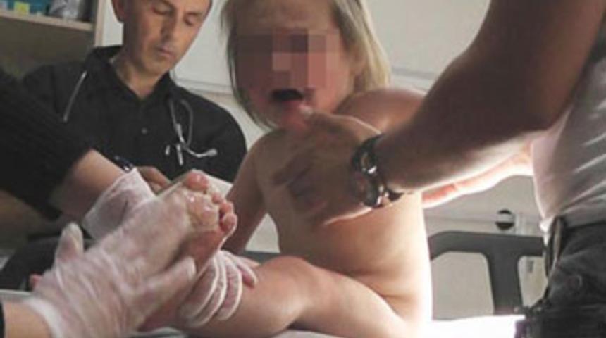 K&uuml;&ccedil;&uuml;k kızın v&uuml;cudunda sigara s&ouml;nd&uuml;rd&uuml;ler