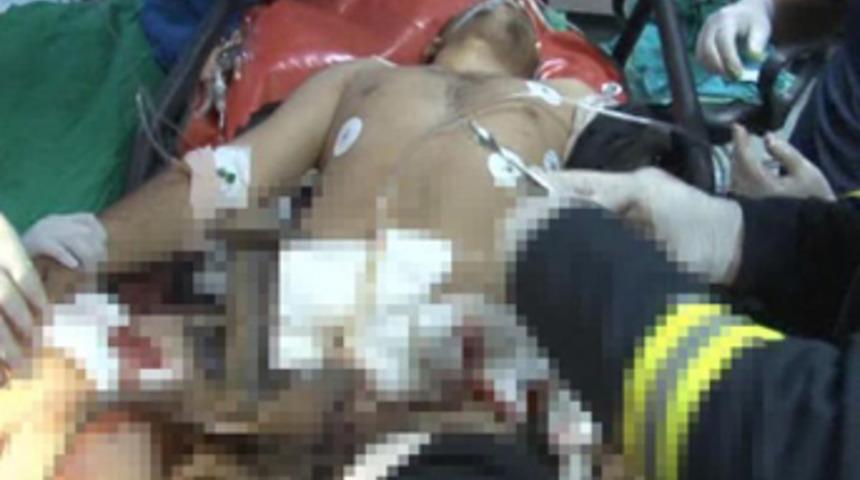 Kopan bacakları yerine dikildi