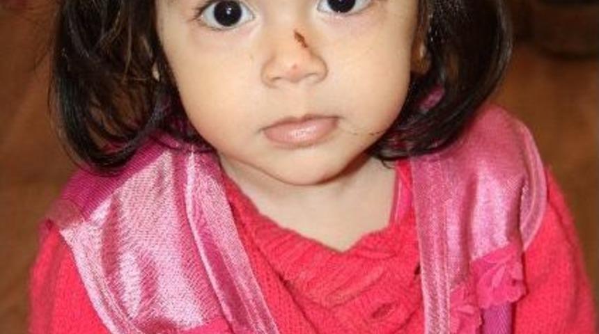 Minik Ezgi Kazadan Burnundaki Çizikle Kurtuldu