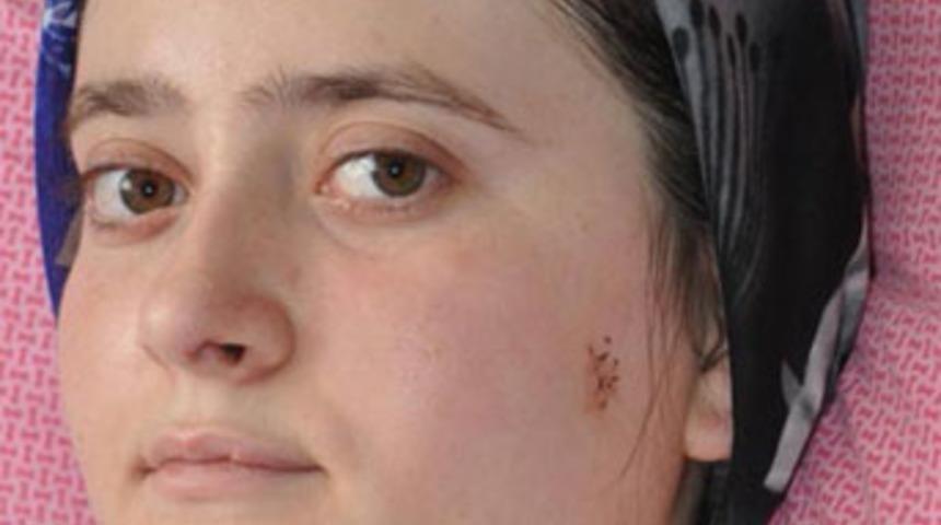 Gözünü açtı, dehşeti anlattı