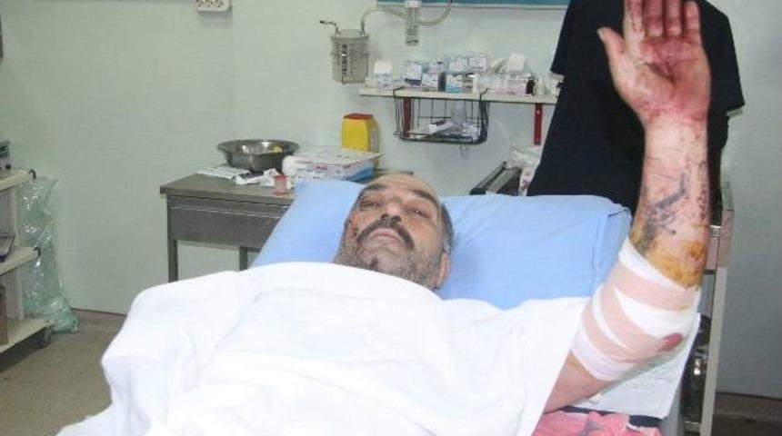 Suriye'den Kilis'e Getirilen 14 Yaralıdan 2'si Hayatını Kaybetti