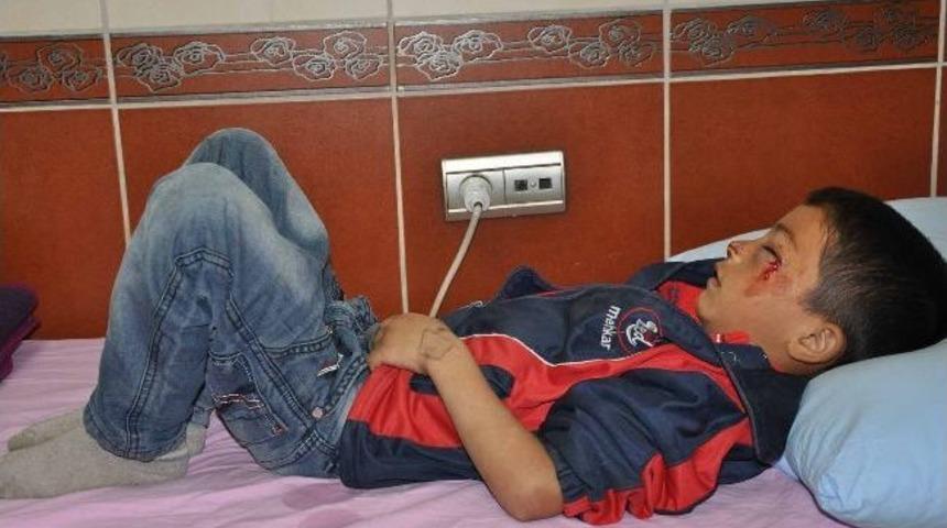 G&ouml;z&uuml;ne Kapı Kolu Giren &Ccedil;ocuk Hastaneye Kaldırıldı