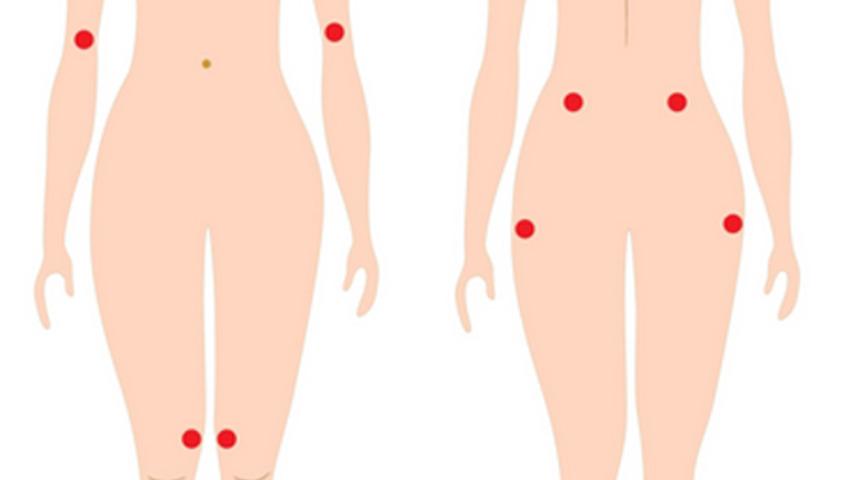 Fibromiyalji en &ccedil;ok kadınlarda g&ouml;r&uuml;l&uuml;yor