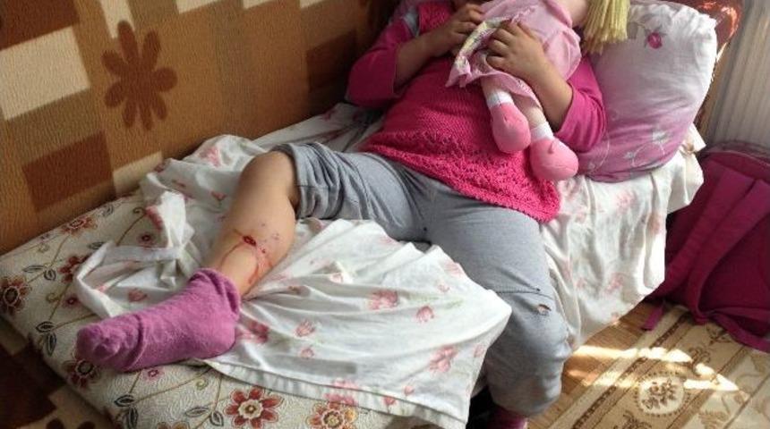 Sokak k&ouml;pekleri k&uuml;&ccedil;&uuml;k kıza saldırdı