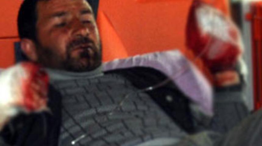 Mayın elinde patladı!