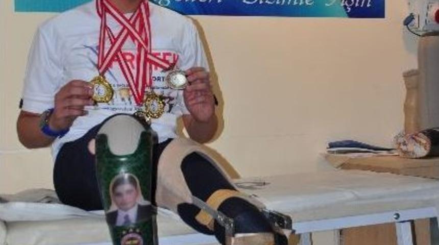 &Ouml;d&uuml;l&uuml; Protez Oldu