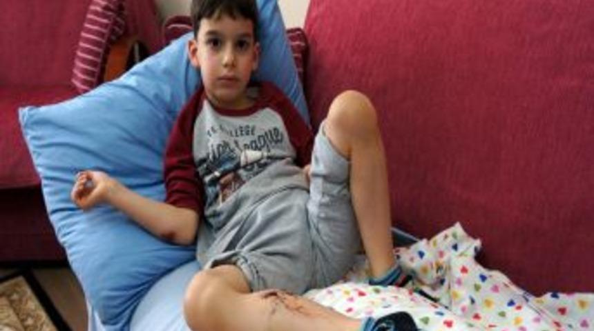 Sultanbeyli'de Sokak K&ouml;peği Yine Bir &Ccedil;ocuğu Isırdı